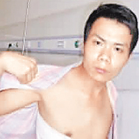張海超為維權自籌經費開胸驗肺。	資料圖片
