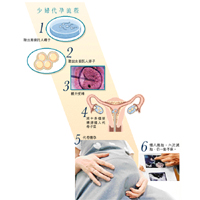 少婦代孕流程