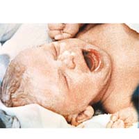 1978年首名試管嬰兒布朗出生。