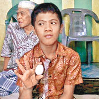 印尼男童肚內「生蛋」