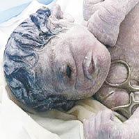 埃及婦誕獨眼無鼻畸嬰
