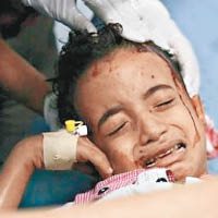也門炮彈擊中受傷  男童死前哭求別埋葬