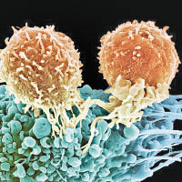 基因細胞療法救癌B