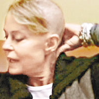  花拉曾在紀錄片公開抗癌剃頭的經過。