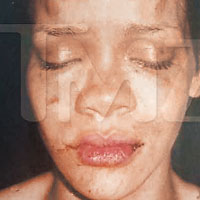 虐打事件令Rihanna身心受創。
