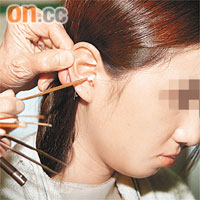 不少人耳塞時會「採耳」清除耳垢，有醫生指耳塞可能是鼻咽癌先兆。	資料圖片