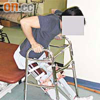 脊髓神經受損的病人可利用步行支架輔助行走。