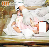 林太的兒子出生時足部骨骼變形向內彎曲。
