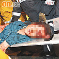 另一名乘客受傷爆眼球。