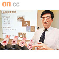 鄔揚源稱，過敏性鼻炎持續，會引致持續咳嗽及氣喘等徵狀。