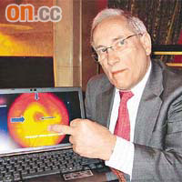 Paul Mitchell指老年黃斑病變患者的視網膜會出現結疤及出血的情況。