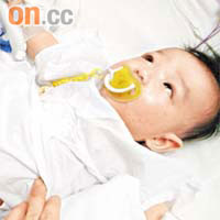 三月大男嬰希希在瑪嘉烈醫院沖涼時，下體被熱水燙傷。