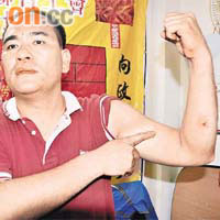 李少坤不滿警方帶走他時態度粗暴，令他手臂受傷。