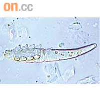 蟎蟲成蟲只有0.3至0.4毫米長。