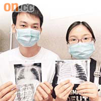 茵茵父母手持台北榮民總醫院治愈同類嬰兒病人的X光照片。