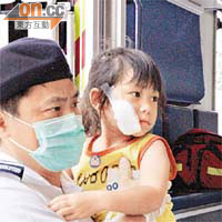 女童面部受傷送院。