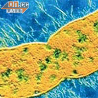 NDM-1大腸桿菌