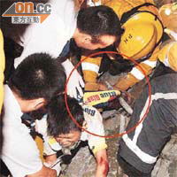 單車小將左大腿遭水管貫穿（紅圈示），被「釘」在山坡痛極大叫。