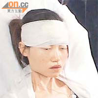 頭部受傷女子送院治理。