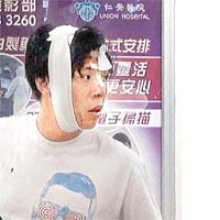 陳俊浩在交通意外中頭部受傷。