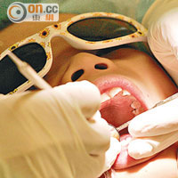 醫知健：小學生牙齒受創 62%因跌倒