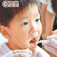 醫知健：幼園37%學童有蛀牙