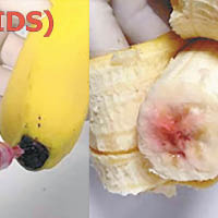 網傳「愛滋香蕉」圖  醫生：食者可中招